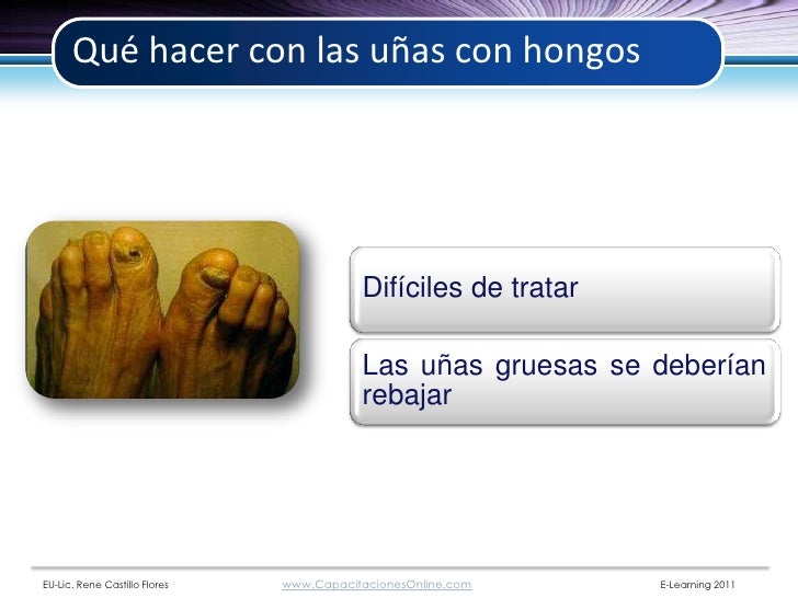 Si puede pasar el hongo de los pie a las manos
