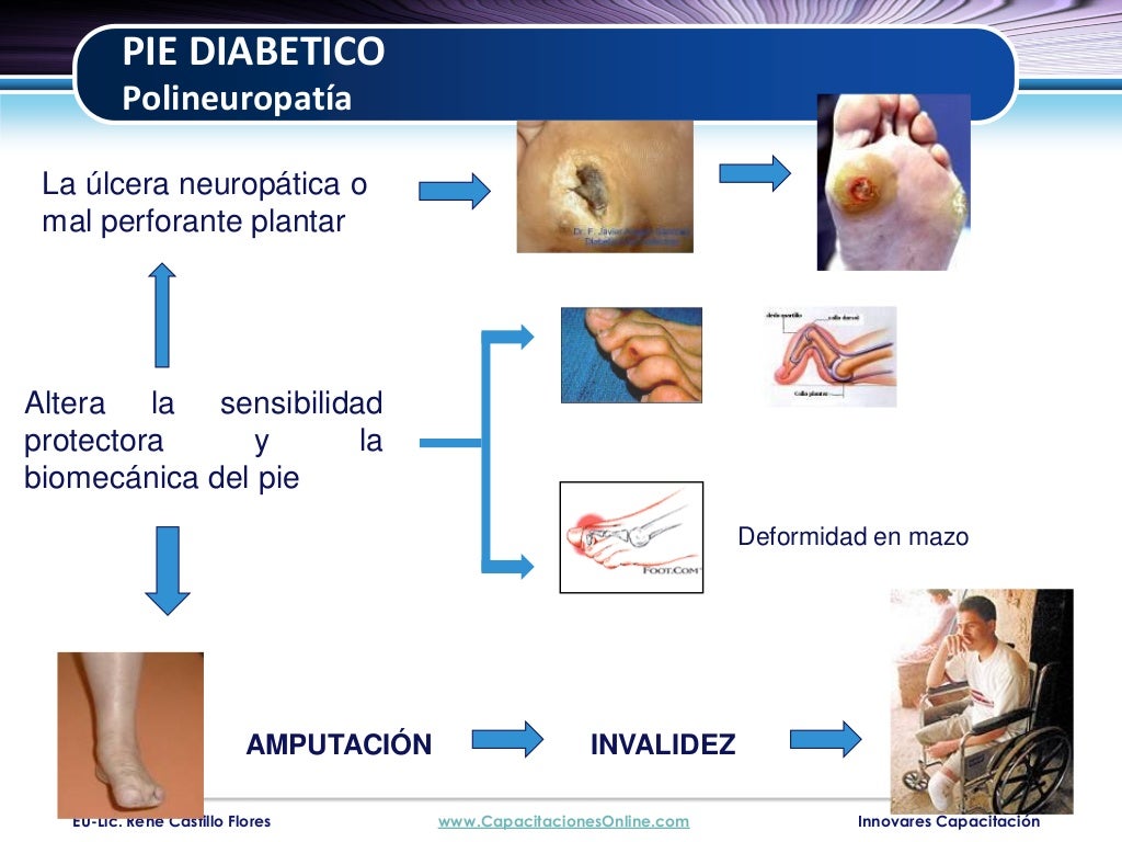 Examen clinico del pie diabetico 2011