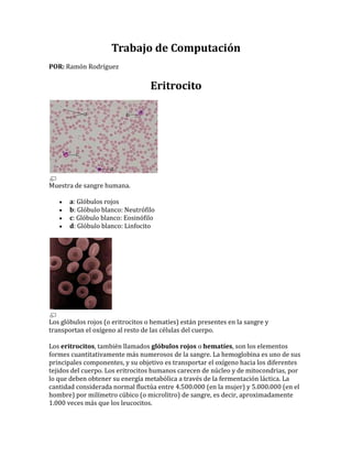 Trabajo de Computación<br />POR: Ramón Rodríguez<br />Eritrocito<br />Muestra de sangre humana.<br />a: Glóbulos rojos<br />b: Glóbulo blanco: Neutrófilo<br />c: Glóbulo blanco: Eosinófilo<br />d: Glóbulo blanco: Linfocito<br />Los glóbulos rojos (o eritrocitos o hematíes) están presentes en la sangre y transportan el oxígeno al resto de las células del cuerpo.<br />Los eritrocitos, también llamados glóbulos rojos o hematíes, son los elementos formes cuantitativamente más numerosos de la sangre. La hemoglobina es uno de sus principales componentes, y su objetivo es transportar el oxígeno hacia los diferentes tejidos del cuerpo. Los eritrocitos humanos carecen de núcleo y de mitocondrias, por lo que deben obtener su energía metabólica a través de la fermentación láctica. La cantidad considerada normal fluctúa entre 4.500.000 (en la mujer) y 5.000.000 (en el hombre) por milímetro cúbico (o microlitro) de sangre, es decir, aproximadamente 1.000 veces más que los leucocitos.<br />Etimología<br />El nombre eritrocito deriva de la combinación de los vocablos griegos ἑρυθρός (erythros), 'rojo', y κύτος (cytos), 'cavidad o recipiente hueco'.[1]<br />Descripción<br />El eritrocito es un disco bicóncavo de más o menos 7 a 7,5 μm de diámetro y de 80 a 100 fL de volumen. La célula ha perdido su ARN residual y sus mitocondrias, así como algunas enzimas importantes; por tanto, es incapaz de sintetizar nuevas proteínas o lípidos.<br />Origen<br />Los eritrocitos derivan de las células madre comprometidas denominadas hemocitoblasto.[2] La eritropoyetina, una hormona de crecimiento producida en los tejidos renales, estimula a la eritropoyesis (es decir, la formación de eritrocitos) y es responsable de mantener una masa eritrocitaria en un estado constante. Los eritrocitos, al igual que los leucocitos, tienen su origen en la médula ósea.<br />Proceso de desarrollo<br />Las etapas de desarrollo morfológico de la célula eritroide incluyen (en orden de madurez creciente) las siguientes etapas:<br />proeritroblasto<br />eritroblasto basófilo<br />eritroblasto policromatófilo<br />eritroblasto ortocromático<br />reticulocito<br />hematíe, finalmente, cuando ya carece de núcleo y mitocondrias.<br />metabolismo.<br />