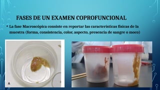 FASES DE UN EXAMEN COPROFUNCIONAL
• La fase Macroscópica consiste en reportar las características físicas de la
muestra (forma, consistencia, color, aspecto, presencia de sangre o moco)
 