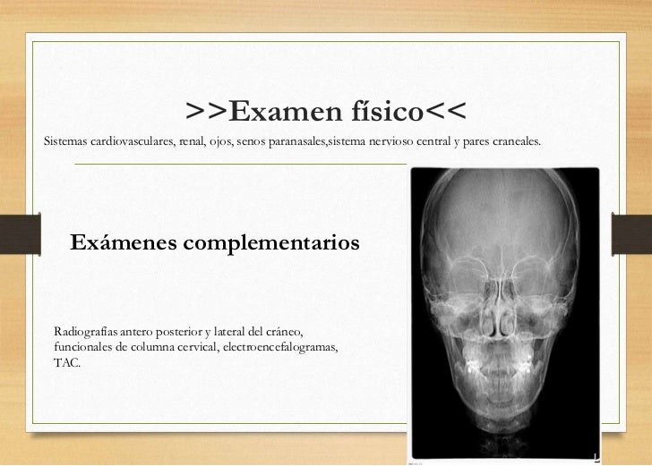 EXAMEN DE CABEZA Y CUELLO. LA CEFALALGIA