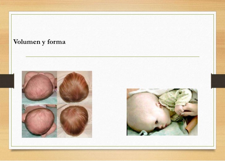 EXAMEN DE CABEZA Y CUELLO. LA CEFALALGIA