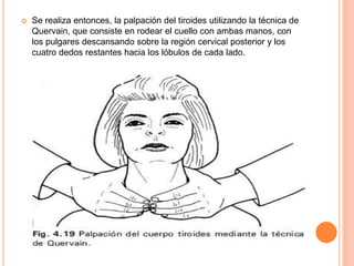 

Se realiza entonces, la palpación del tiroides utilizando la técnica de
Quervain, que consiste en rodear el cuello con ambas manos, con
los pulgares descansando sobre la región cervical posterior y los
cuatro dedos restantes hacia los lóbulos de cada lado.

 