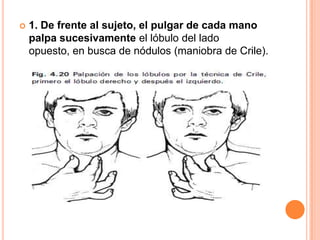 

1. De frente al sujeto, el pulgar de cada mano
palpa sucesivamente el lóbulo del lado
opuesto, en busca de nódulos (maniobra de Crile).

 