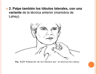 

2. Palpe también los lóbulos laterales, con una
variante de la técnica anterior (maniobra de
Lahey).

 
