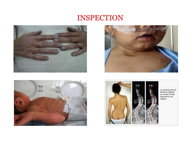 Examen de l appareil respiratoire