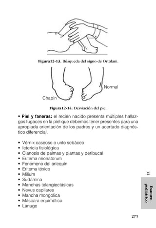 Figura12-13. Búsqueda del signo de Ortolani.




                                               Normal

             Chapín

                 Figura12-14. Desviación del pie.

• Piel y faneras: el recién nacido presenta múltiples hallaz-
gos fugaces en la piel que debemos tener presentes para una
apropiada orientación de los padres y un acertado diagnós-
tico diferencial.

•   Vérnix caseoso o unto sebáceo
•   Ictericia fisiológica
•   Cianosis de palmas y plantas y peribucal
•   Eritema neonatorum
•   Fenómeno del arlequín
•   Eritema tóxico
                                                                 12




•   Milium
•   Sudamina
•   Manchas telangiectásicas
                                                                pediátrico
                                                                 Examen




•   Nevus capilares
•   Mancha mongólica
•   Máscara equimótica
•   Lanugo

                                                          271
 