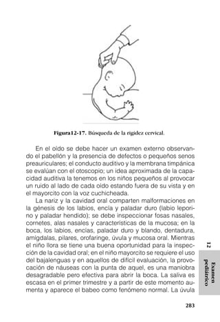 Figura12-17. Búsqueda de la rigidez cervical.

    En el oído se debe hacer un examen externo observan-
do el pabellón y la presencia de defectos o pequeños senos
preauriculares; el conducto auditivo y la membrana timpánica
se evalúan con el otoscopio; un idea aproximada de la capa-
cidad auditiva la tenemos en los niños pequeños al provocar
un ruido al lado de cada oído estando fuera de su vista y en
el mayorcito con la voz cuchicheada.
    La nariz y la cavidad oral comparten malformaciones en
la génesis de los labios, encía y paladar duro (labio lepori-
no y paladar hendido); se debe inspeccionar fosas nasales,
cornetes, alas nasales y características de la mucosa; en la
boca, los labios, encías, paladar duro y blando, dentadura,
amígdalas, pilares, orofaringe, úvula y mucosa oral. Mientras
el niño llora se tiene una buena oportunidad para la inspec-
                                                                    12




ción de la cavidad oral; en el niño mayorcito se requiere el uso
del bajalenguas y en aquellos de difícil evaluación, la provo-
                                                                   pediátrico
                                                                    Examen




cación de náuseas con la punta de aquel, es una maniobra
desagradable pero efectiva para abrir la boca. La saliva es
escasa en el primer trimestre y a partir de este momento au-
menta y aparece el babeo como fenómeno normal. La úvula

                                                            283
 