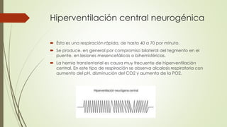 Hiperventilación central neurogénica
 Ésta es una respiración rápida, de hasta 40 a 70 por minuto.
 Se produce, en general por compromiso bilateral del tegmento en el
puente, en lesiones mesencefálicas o bihemisféricas.
 La hernia transtentorial es causa muy frecuente de hiperventilación
central. En este tipo de respiración se observa alcalosis respiratoria con
aumento del pH, disminución del CO2 y aumento de la PO2.
 