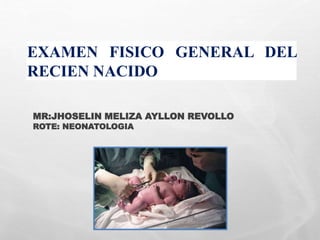 EXAMEN FISICO GENERAL DEL
RECIEN NACIDO
MR:JHOSELIN MELIZA AYLLON REVOLLO
ROTE: NEONATOLOGIA
 