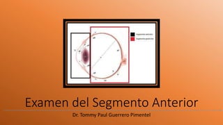 Examen del Segmento Anterior
Dr. Tommy Paul Guerrero Pimentel
 