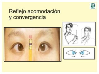 Examen de parescraneales | PPTX