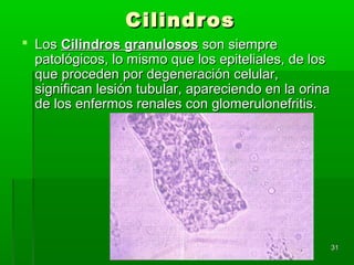 Cilindros
 Los Cilindros granulosos son siempre
  patológicos, lo mismo que los epiteliales, de los
  que proceden por degeneración celular,
  significan lesión tubular, apareciendo en la orina
  de los enfermos renales con glomerulonefritis.




                                                       31
 