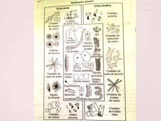 Sedimento Urinario
 