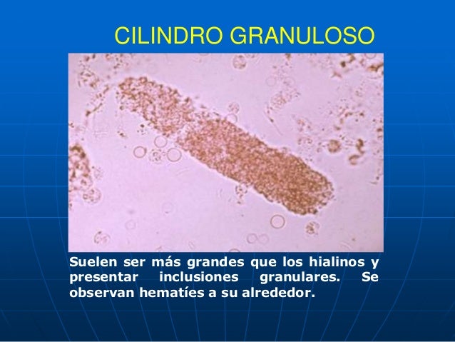 Imagen relacionada