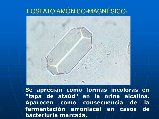 Examen de orina completa