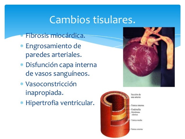 Cómo hipertensión arterial reactiva ?