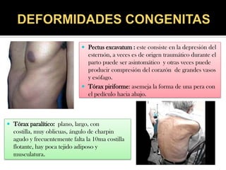  Pectus excavatum : este consiste en la depresión del
                               esternón, a veces es de origen traumático durante el
                               parto puede ser asintomático y otras veces puede
                               producir compresión del corazón de grandes vasos
                               y esófago.
                              Tórax piriforme: asemeja la forma de una pera con
                               el pedículo hacia abajo.



 Tórax paralítico: plano, largo, con
  costilla, muy oblicuas, ángulo de charpin
  agudo y frecuentemente falta la 10ma costilla
  flotante, hay poca tejido adiposo y
  musculatura.
 