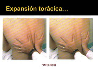 POSTERIOR
 