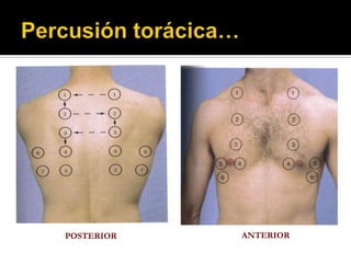 POSTERIOR   ANTERIOR
 