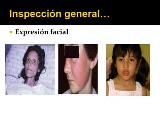    Expresión facial
 