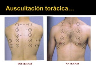 POSTERIOR   ANTERIOR
 