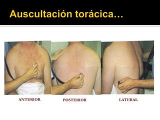 ANTERIOR   POSTERIOR   LATERAL
 