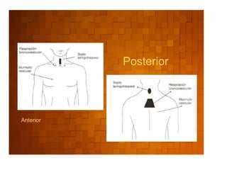 Posterior




Anterior
 