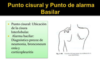   Punto cisural: Ubicación
    de la cisura
    Interlobular.
    Alarma bacilar:
    Diagnóstico precoz de
    neumonía, bronconeum
    onía y
    corticopleuritis
 