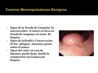    Signo de la Tienda de Campaña: la
    mucosa sobre el tumor se eleva en
    tienda de campaña a la toma de
    biopsia.
   Signo de Schindler: Conservación
    de los pliegues mucosos, pasan
    sobre el tumor.
   Signo del cojín: en caso de
    lipomas, puede dejar huella la
    compresión con la pinza de
    biopsia.
 