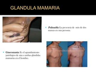 GLANDULA MAMARIA


                                         PolimatSía: La presencia de más de dos
                                          mamas en una persona.




 Ginecomastia: Es el agrandamiento
  patológico de una o ambas glándulas
  mamarias en el hombre.
 