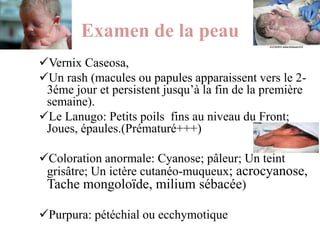 Vernox Rash EXAMEN DU NOUVEAU NE 2022.pptx