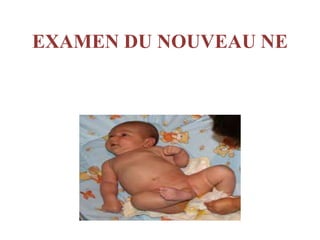 Examen clinique neurologique du nouveau-né