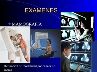 EXAMENESEXAMENES
MAMOGRAFIA
Reducción de mortalidad por cáncer de
mama
 
