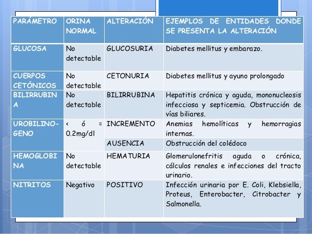 Stress (45) - Stress Stress (45) - Stress