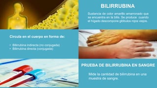Sustancia de color amarillo amarronado que
se encuentra en la bilis. Se produce cuando
el hígado descompone glóbulos rojos viejos.
BILIRRUBINA
Mide la cantidad de bilirrubina en una
muestra de sangre.
• Bilirrubina indirecta (no conjugada)
• Bilirrubina directa (conjugada)
Circula en el cuerpo en forma de:
PRUEBA DE BILIRRUBINA EN SANGRE
 