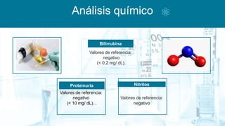 Análisis químico
Proteinuria
Valores de referencia:
negativo
(< 10 mg/ dL). .
Nitritos
.
Bilirrubina
Valores de referencia:
negativo
(< 0,2 mg/ dL).
Valores de referencia:
negativo
 