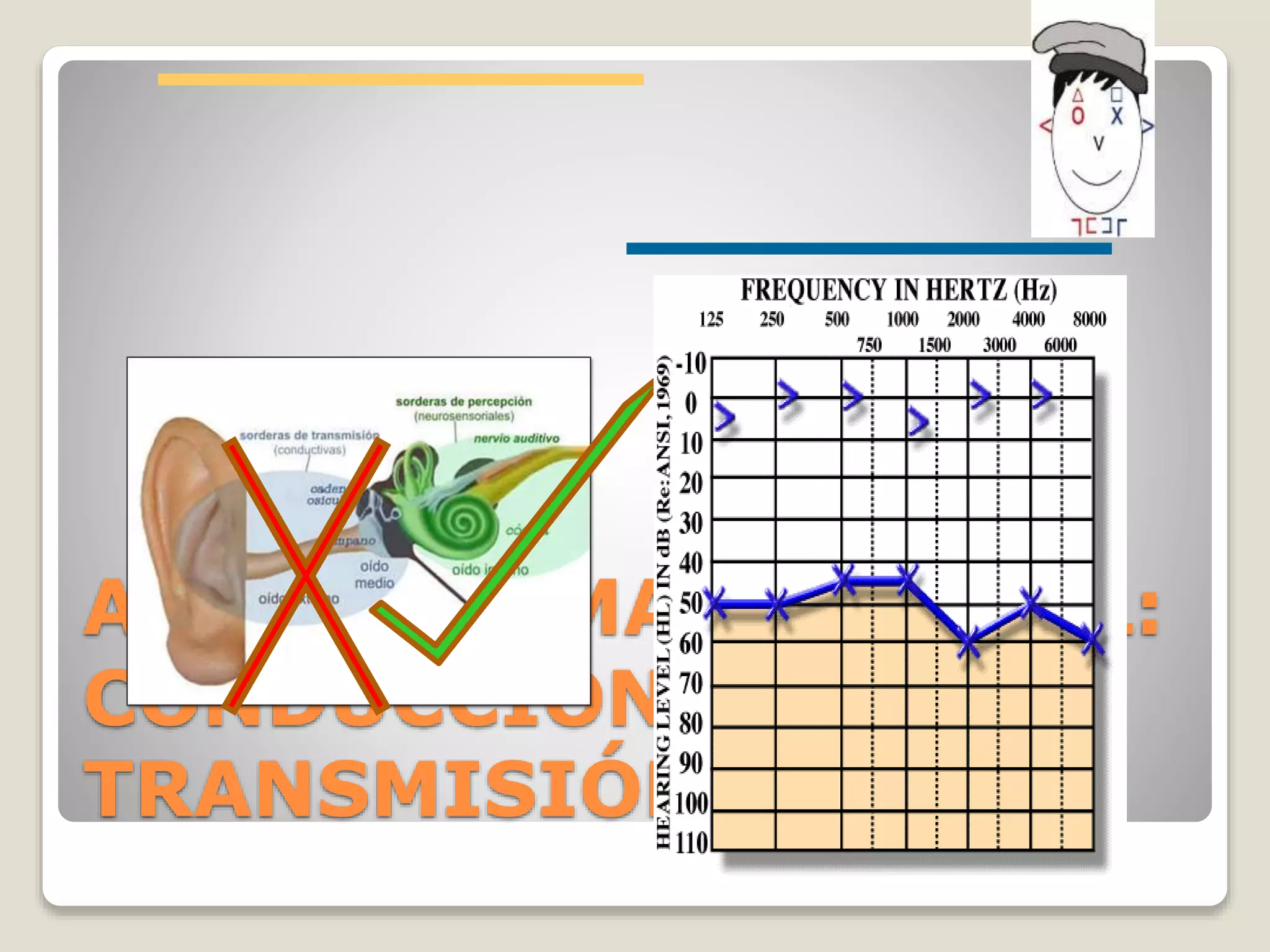 AUDIOGRAMA ANORMAL:
CONDUCCIÓN O
TRANSMISIÓN
 