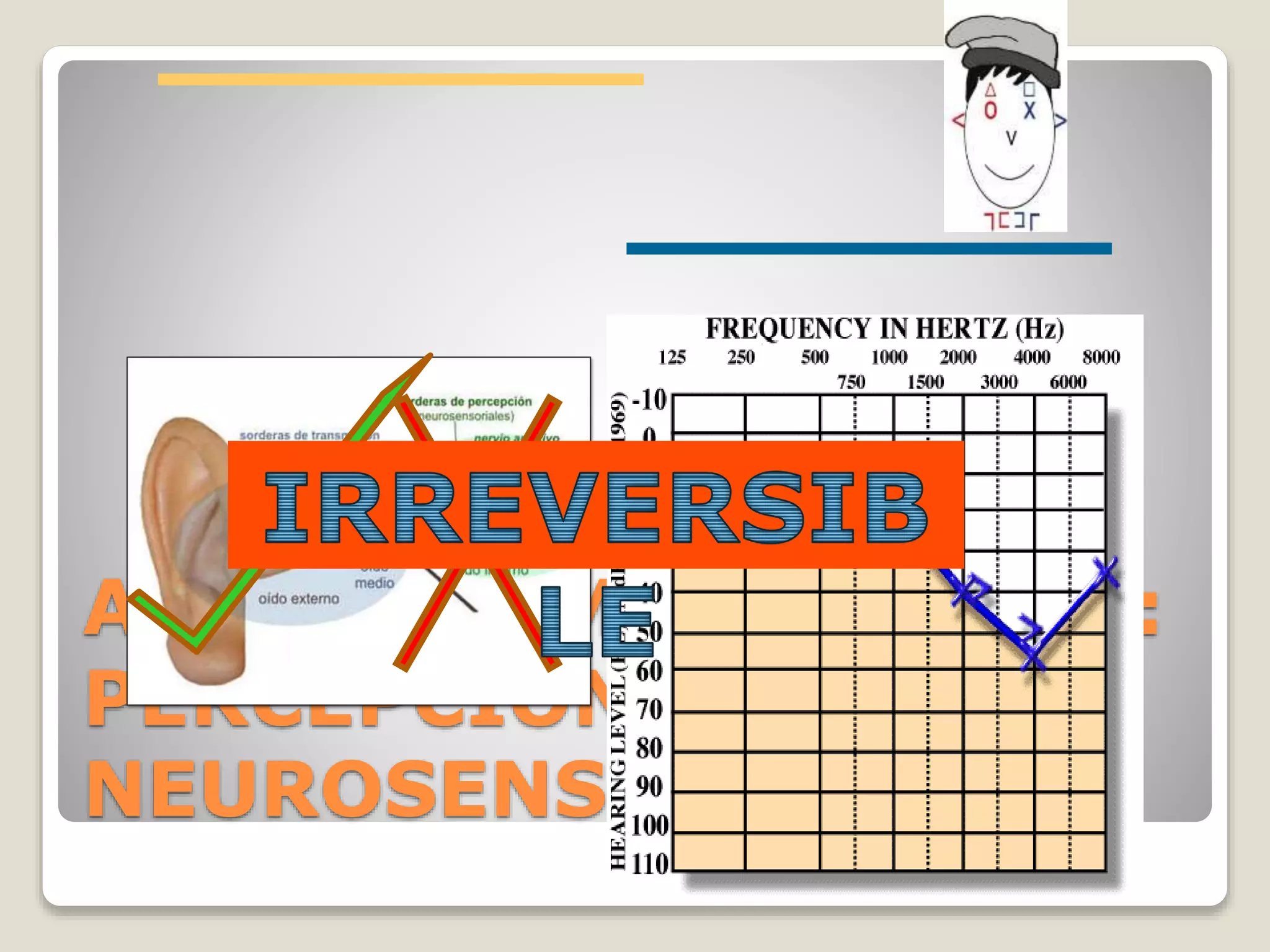 AUDIOGRAMA ANORMAL:
PERCEPCIÓN O
NEUROSENSORIAL
 