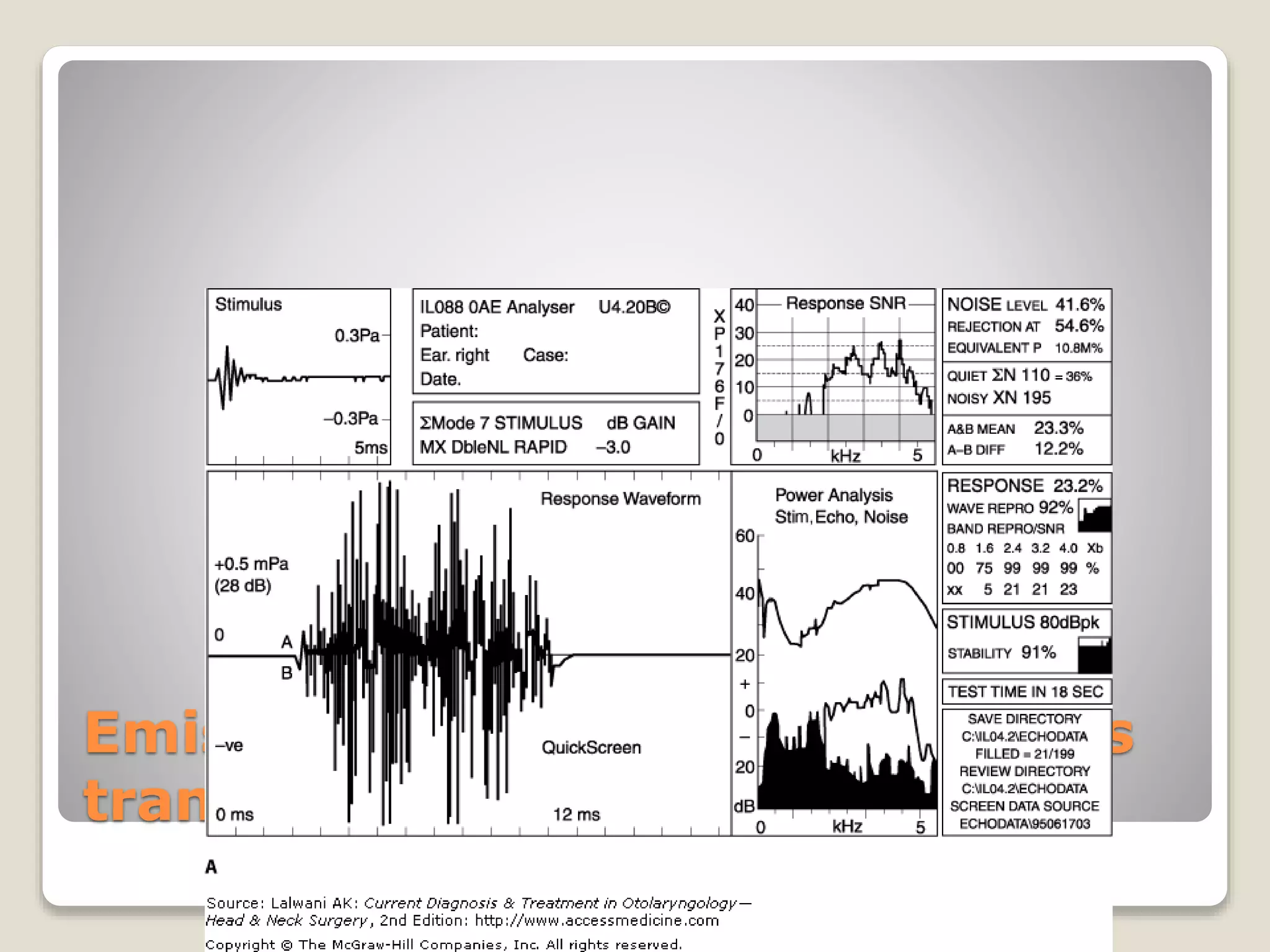 Emisiones otoacústicas evocadas
transitorias
 