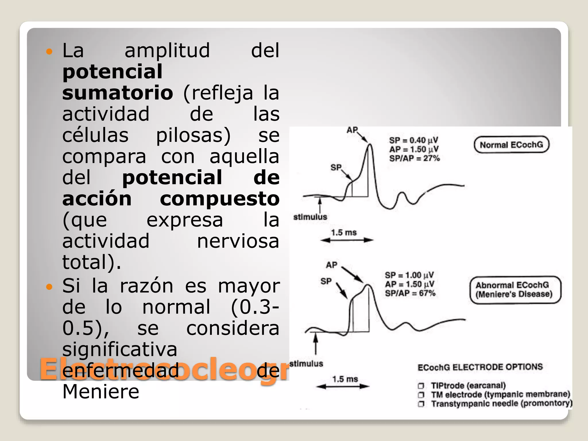 Electrococleografía
 La amplitud del
potencial
sumatorio (refleja la
actividad de las
células pilosas) se
compara con aquella
del potencial de
acción compuesto
(que expresa la
actividad nerviosa
total).
 Si la razón es mayor
de lo normal (0.3-
0.5), se considera
significativa
enfermedad de
Meniere
 
