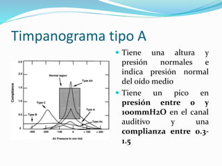 Timpanograma tipo A
 Tiene una altura y
presión normales e
indica presión normal
del oído medio
 Tiene un pico en
presión entre 0 y
1oommH2O en el canal
auditivo y una
complianza entre 0.3-
1.5
 