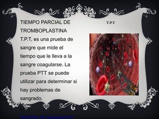 T.P.TTIEMPO PARCIAL DE
TROMBOPLASTINA
T.P.T, es una prueba de
sangre que mide el
tiempo que le lleva a la
sangre coagularse. La
prueba PTT se puede
utilizar para determinar si
hay problemas de
sangrado.
Los
factores de coagulación
 
