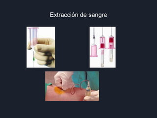 Extracción de sangre
 