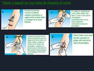 Pasos a seguir en una toma de muestra al vacío
 