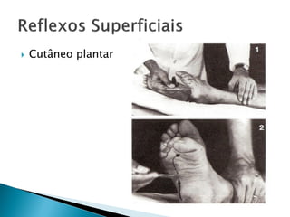    Cutâneo plantar
 