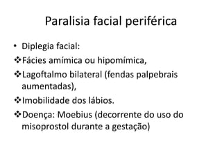 Paralisia facial periférica
• Diplegia facial:
Fácies amímica ou hipomímica,
Lagoftalmo bilateral (fendas palpebrais
aumentadas),
Imobilidade dos lábios.
Doença: Moebius (decorrente do uso do
misoprostol durante a gestação)
 
