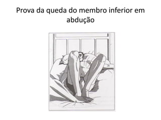 Prova da queda do membro inferior em
abdução
 