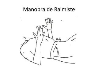 Manobra de Raimiste
 