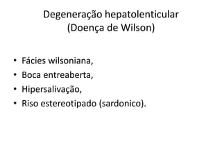 Degeneração hepatolenticular
(Doença de Wilson)
• Fácies wilsoniana,
• Boca entreaberta,
• Hipersalivação,
• Riso estereotipado (sardonico).
 